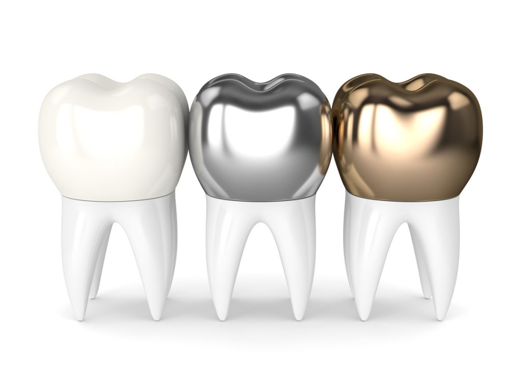 Compared to fillings which just cover a small portion of a tooth, a crown (or cap) encases the entire visible portion of a tooth.