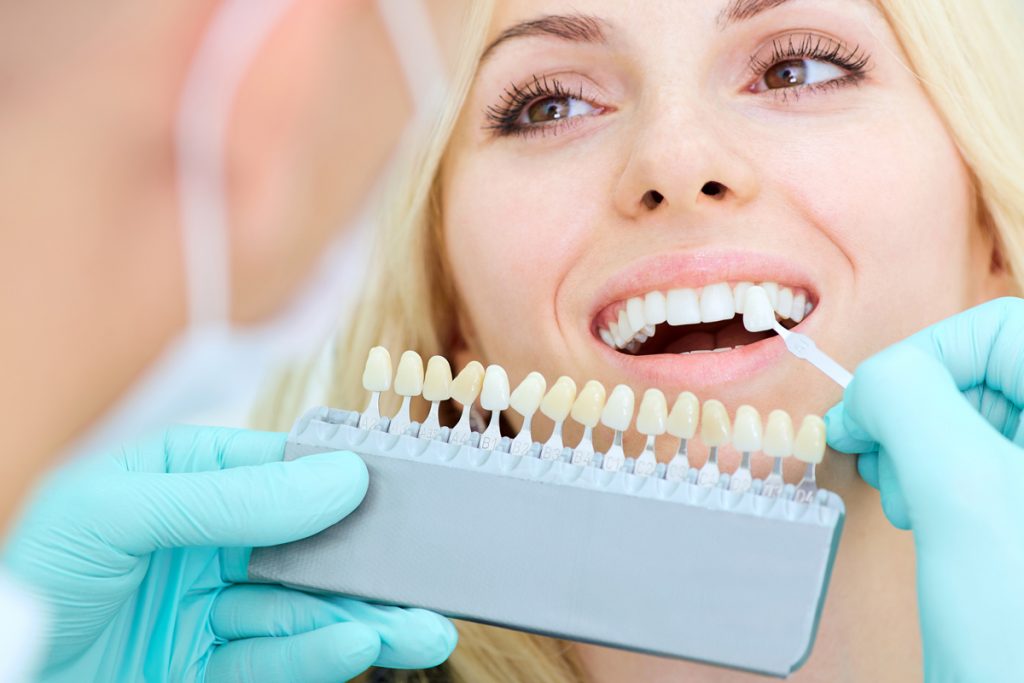 Dental veneers are thin custom made shells that cover the front surface of your tooth to improve their appearance.